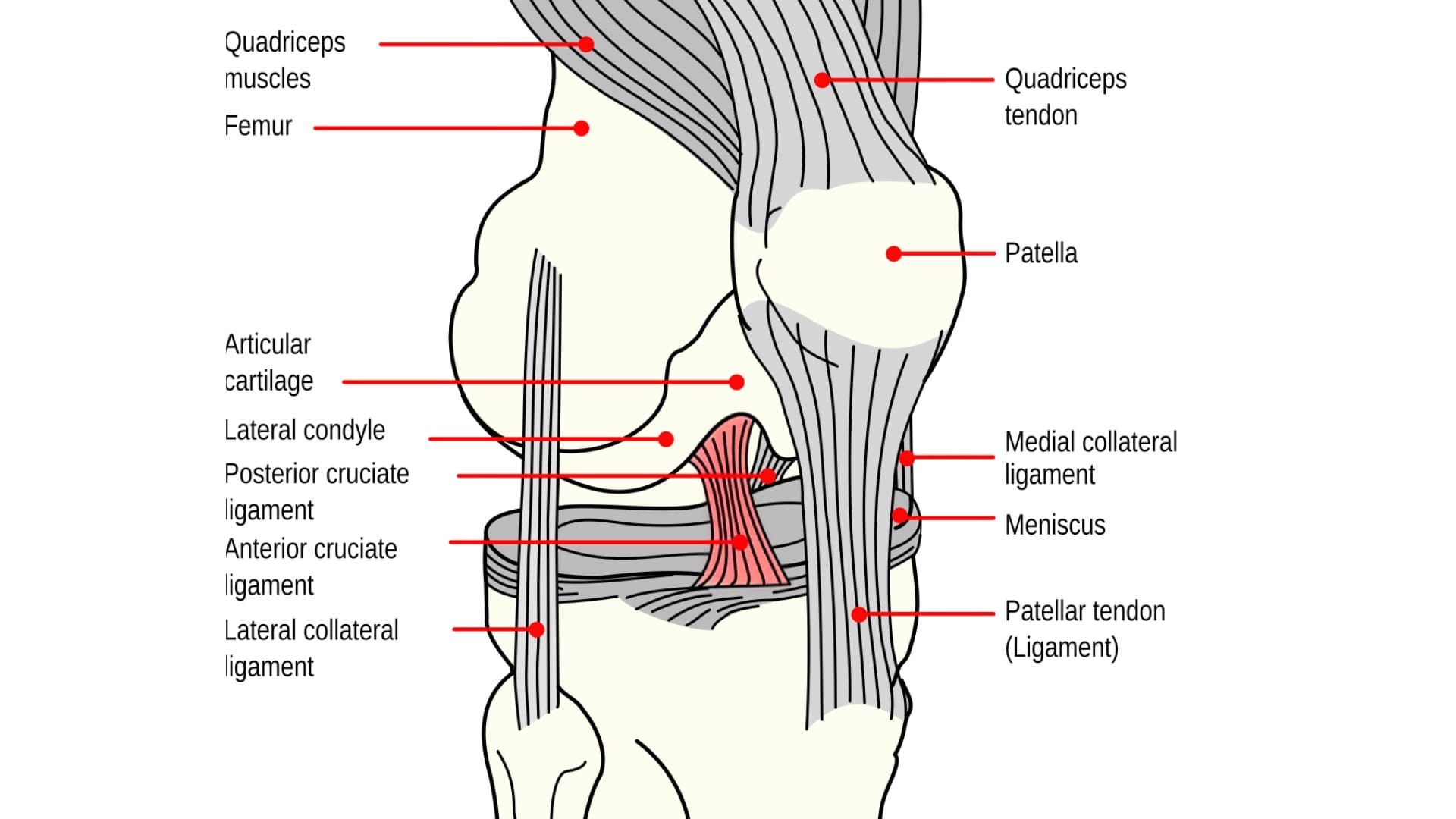 What is an ACL