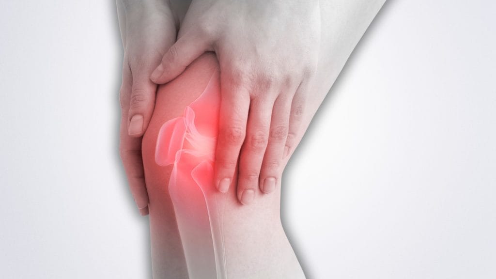 Can an ACL Injury Cause Arthritis