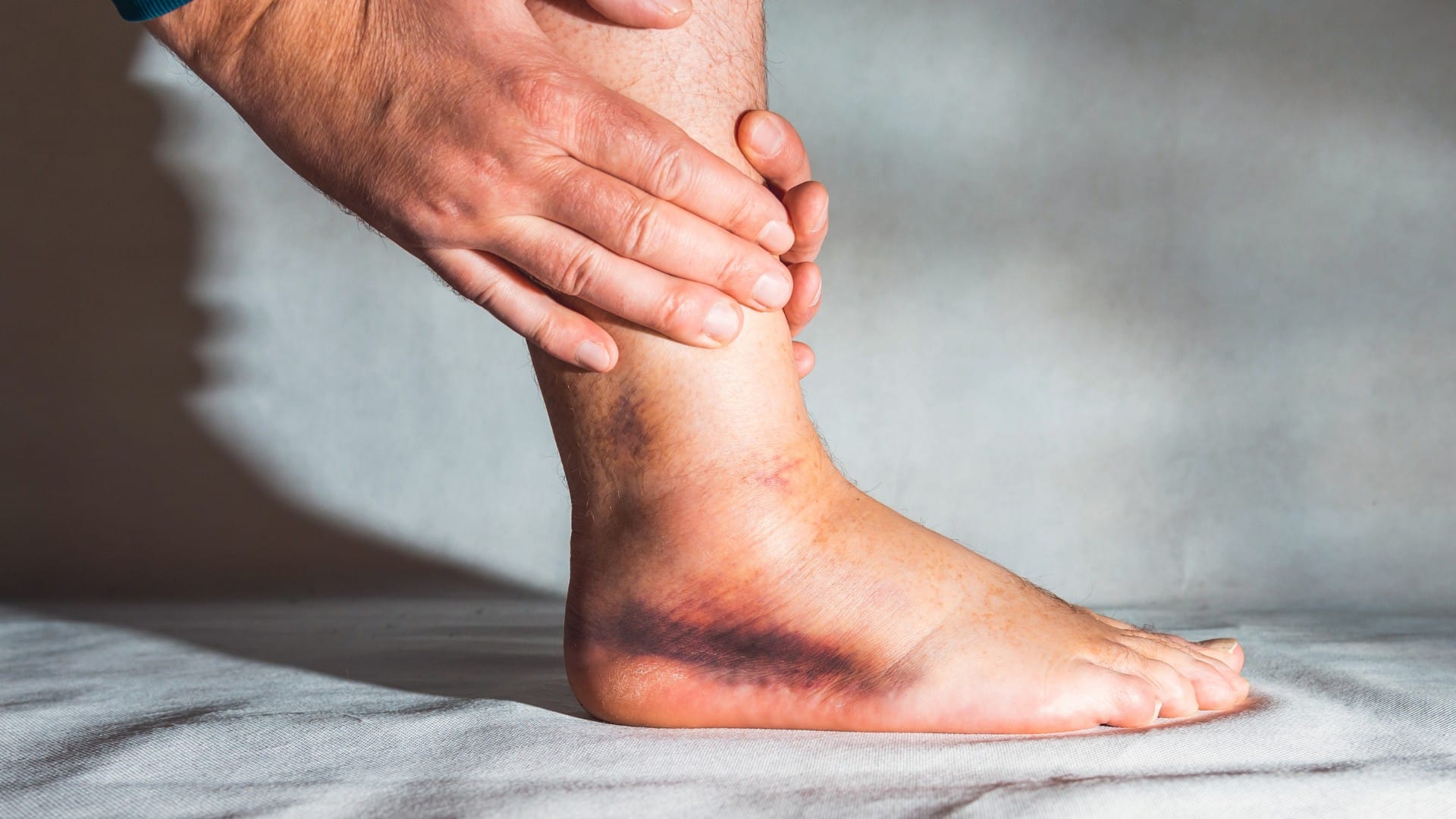 Medial Ankle Instability