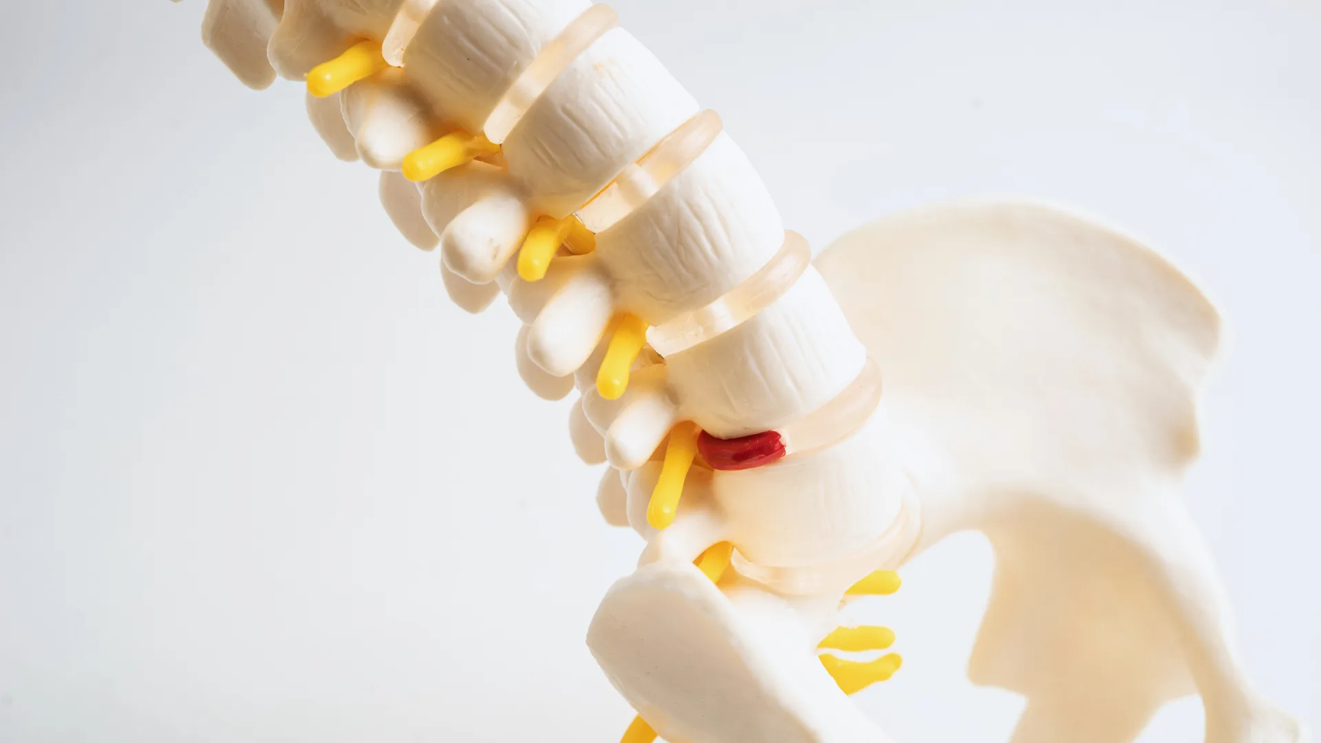 Why Back Muscle Spasms Can Be So Painful