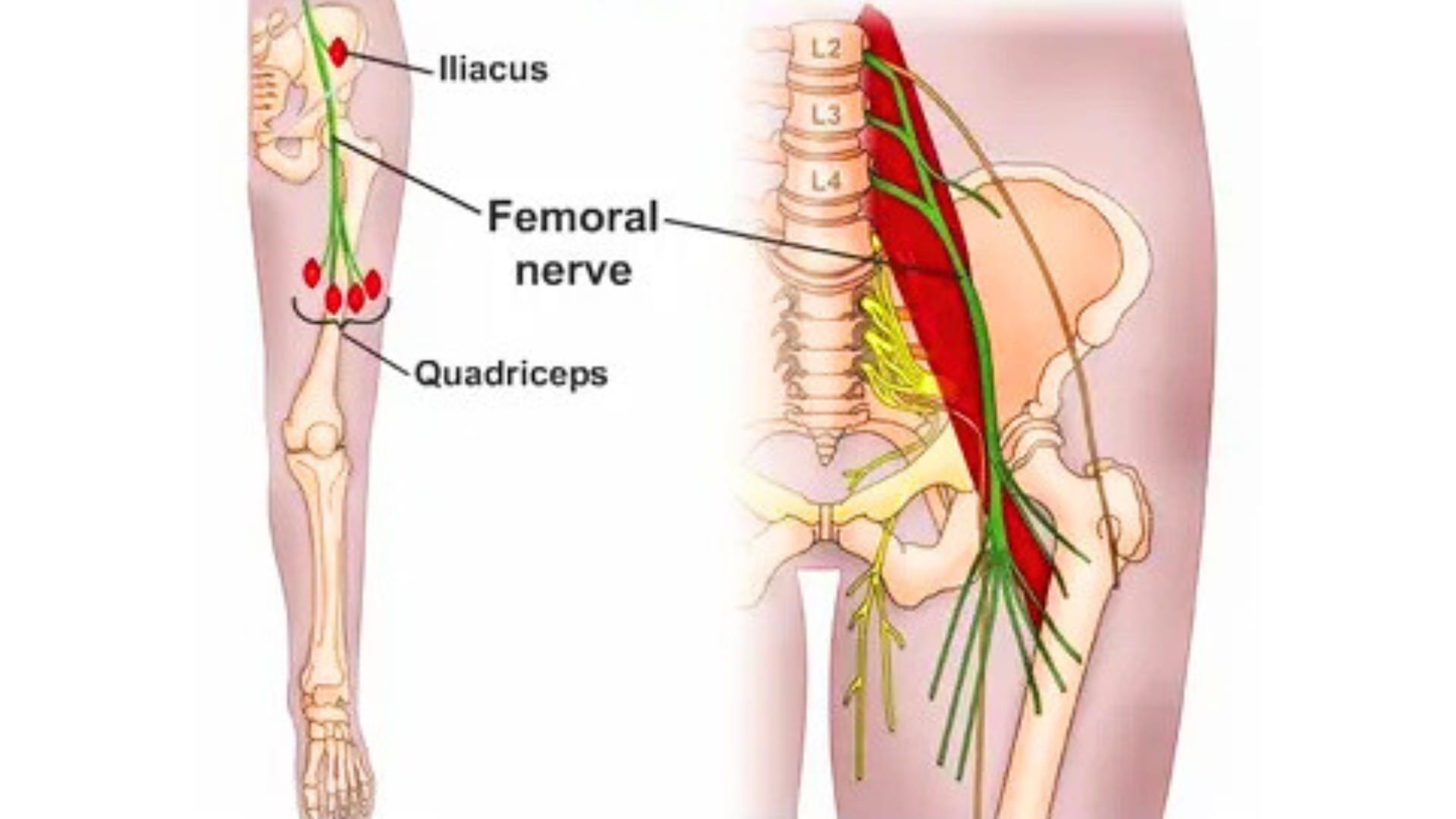 Causes of femoral nerve pain