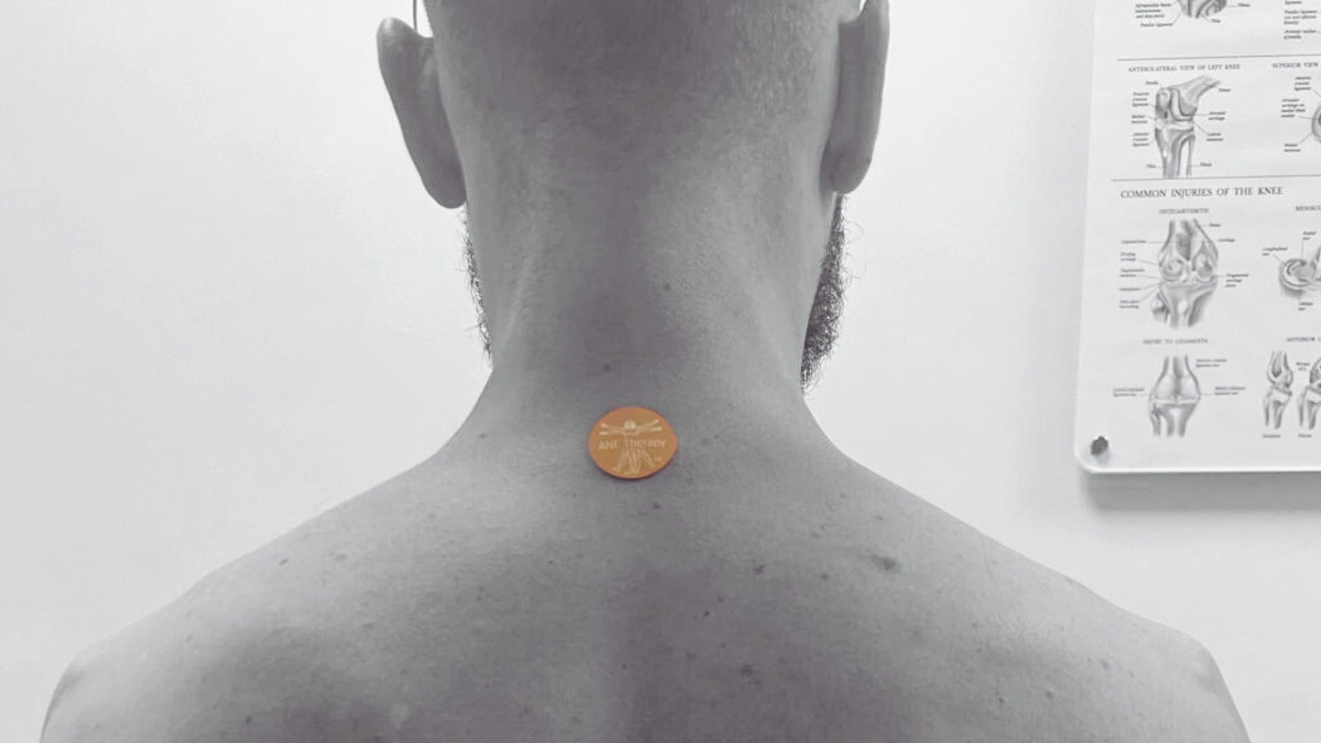 How Does ANF Therapy® Help Manage Muscle Strain