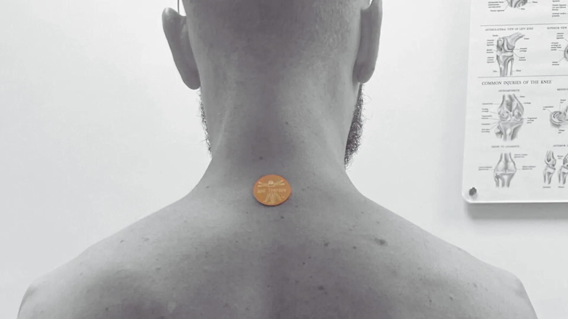 How Does ANF Therapy® Help Manage Muscle Strain