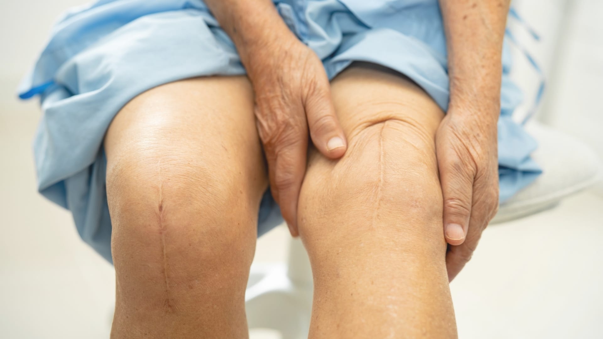 How Is It Different from an MCL Tear