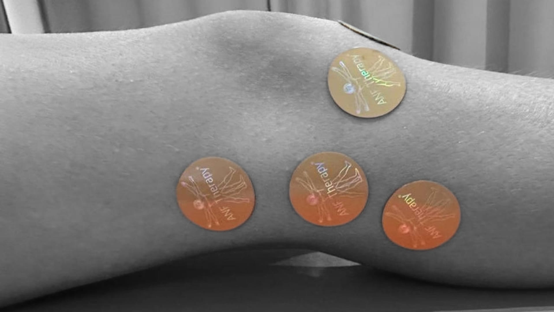 How to Manage Hamstring-Related Knee Swelling