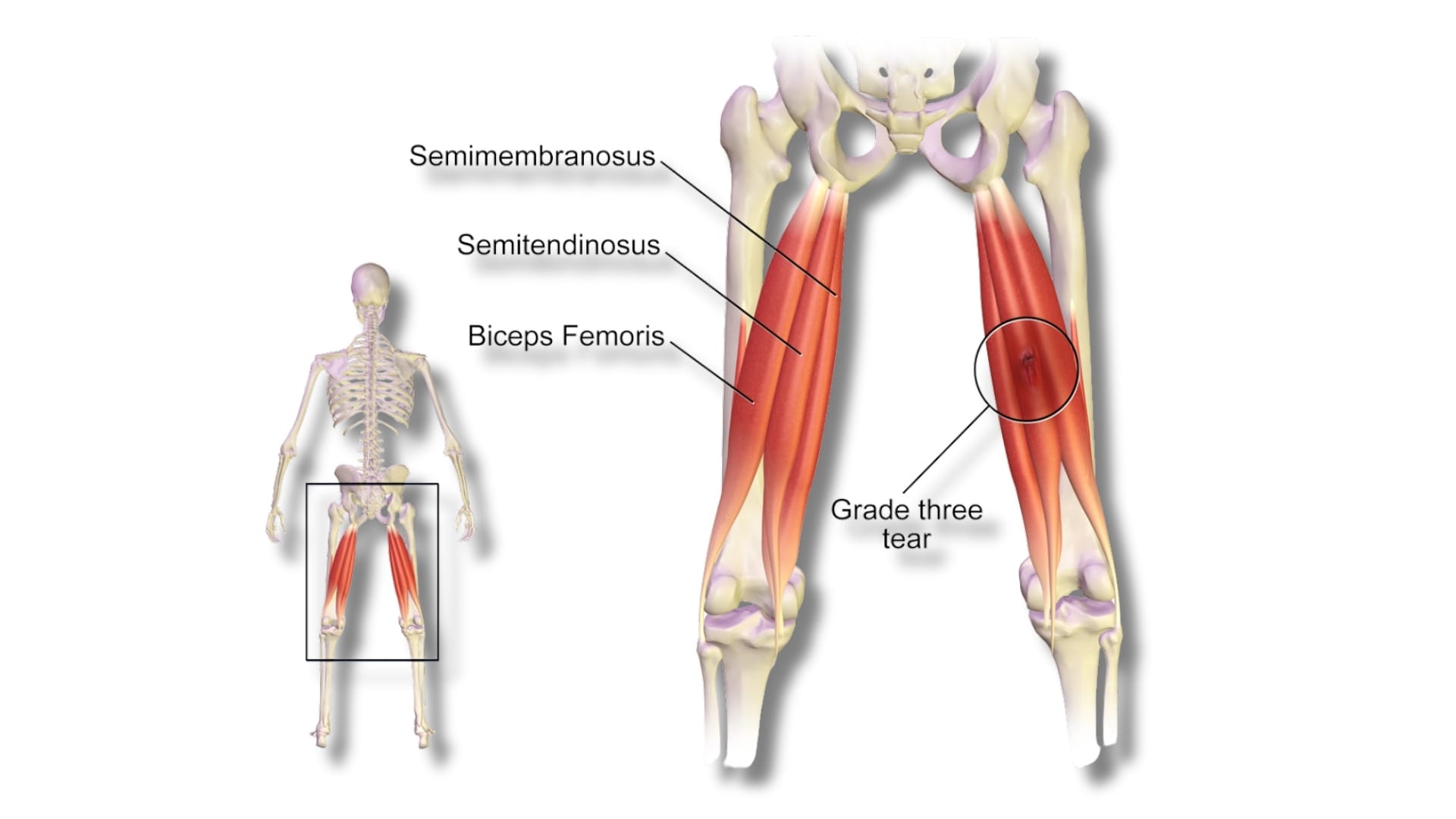 What are the Hamstring Muscles