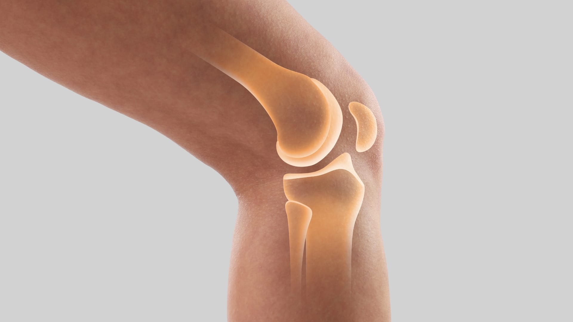 When Knee Swelling May Indicate Something More